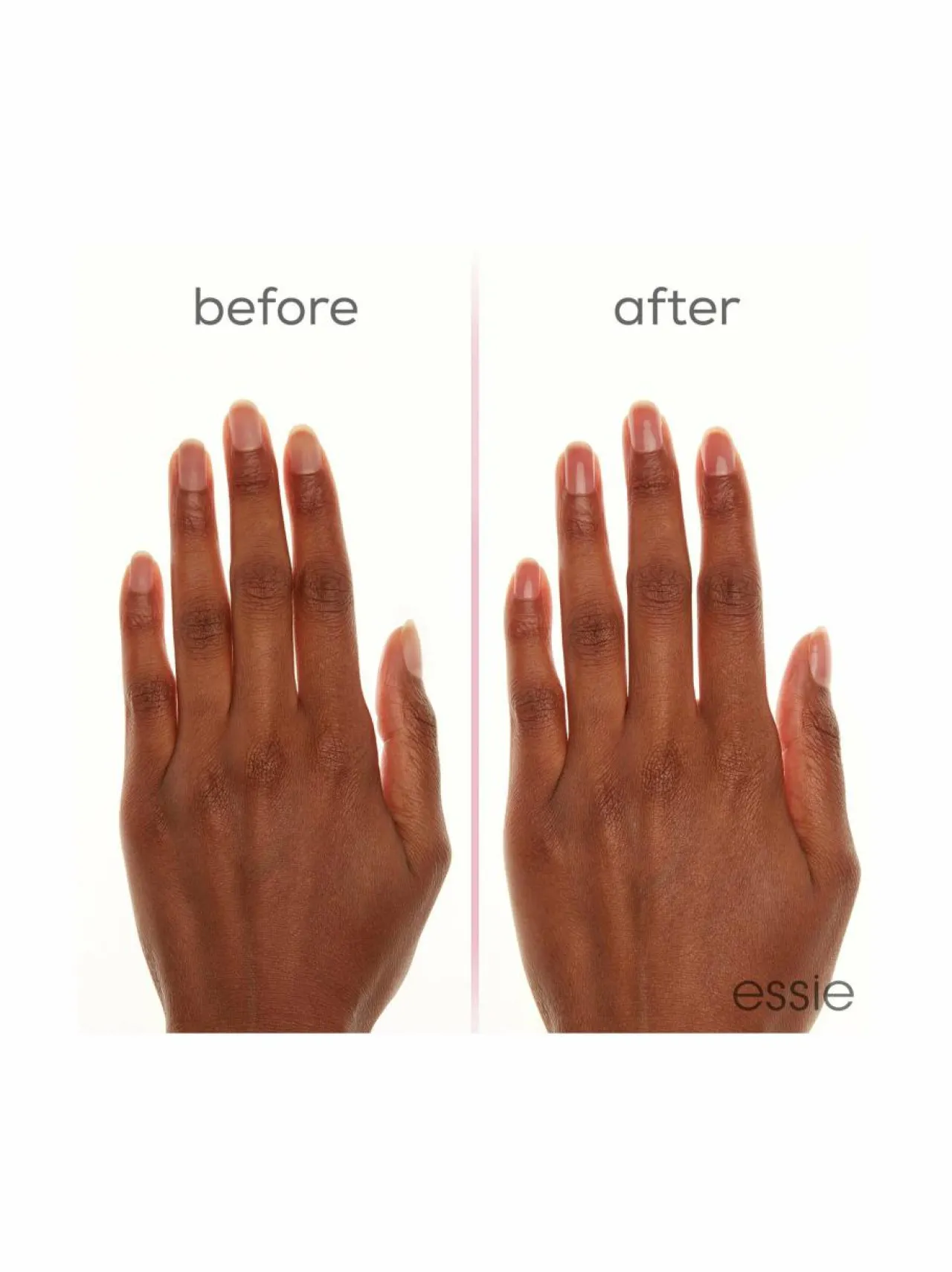 Kynnet<Essie Hard to Resist -kynnenvahvistaja 13,5 ml