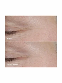 Clinique Smart Clinical Repair™ AM/PM Retinoid Balm -tehohoito^ Kasvojenhoito
