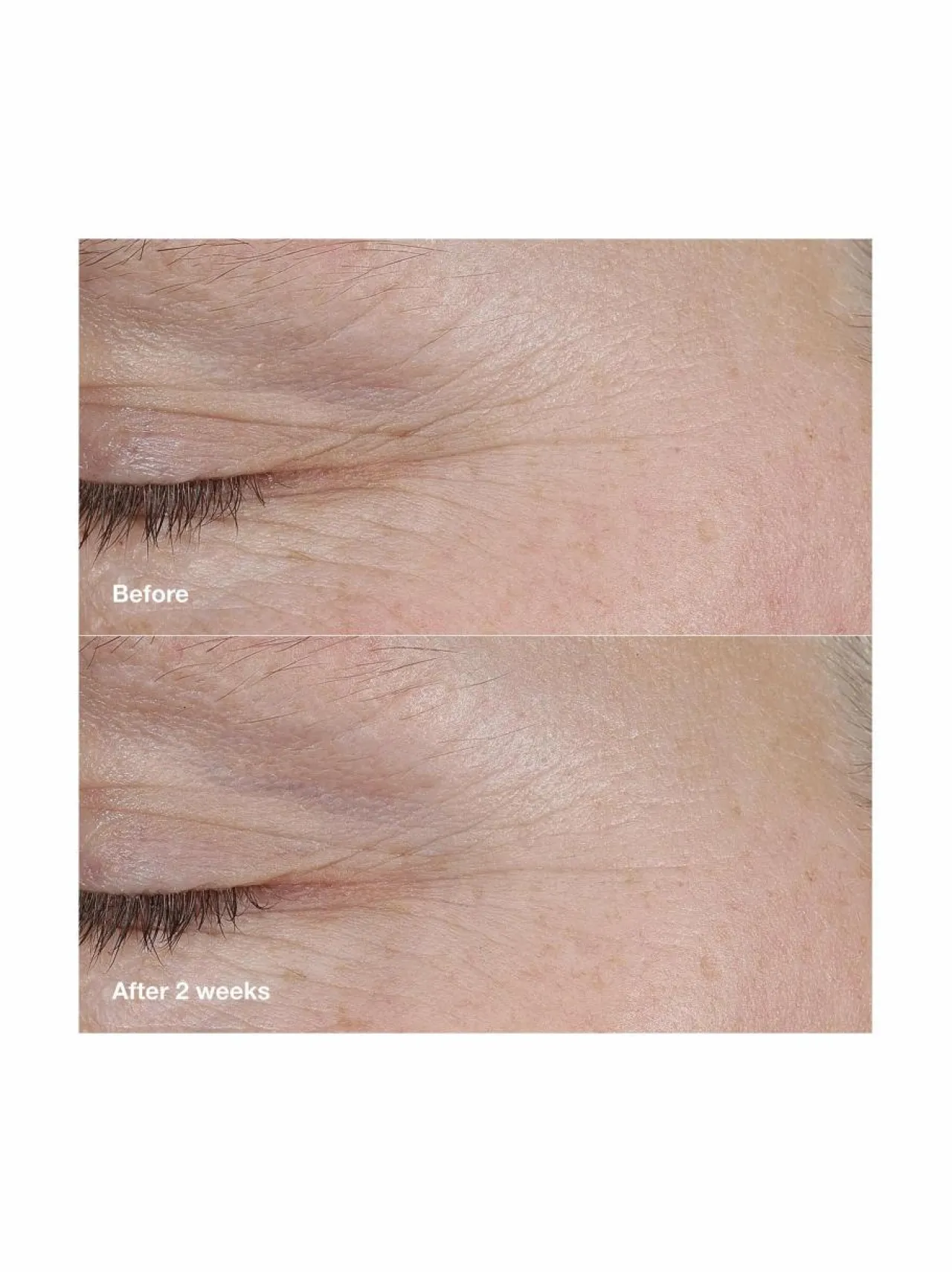 Clinique Smart Clinical Repair™ AM/PM Retinoid Balm -tehohoito^ Kasvojenhoito