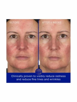Kasvojenhoito<Augustinus Bader The Hydrogel Face Mask -kasvonaamio